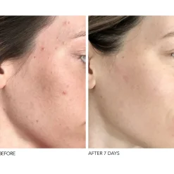 Alpha Beta® Universal Daily Peel 30 Pack