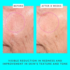 Bouncy Brightfacial™ Face Mask
