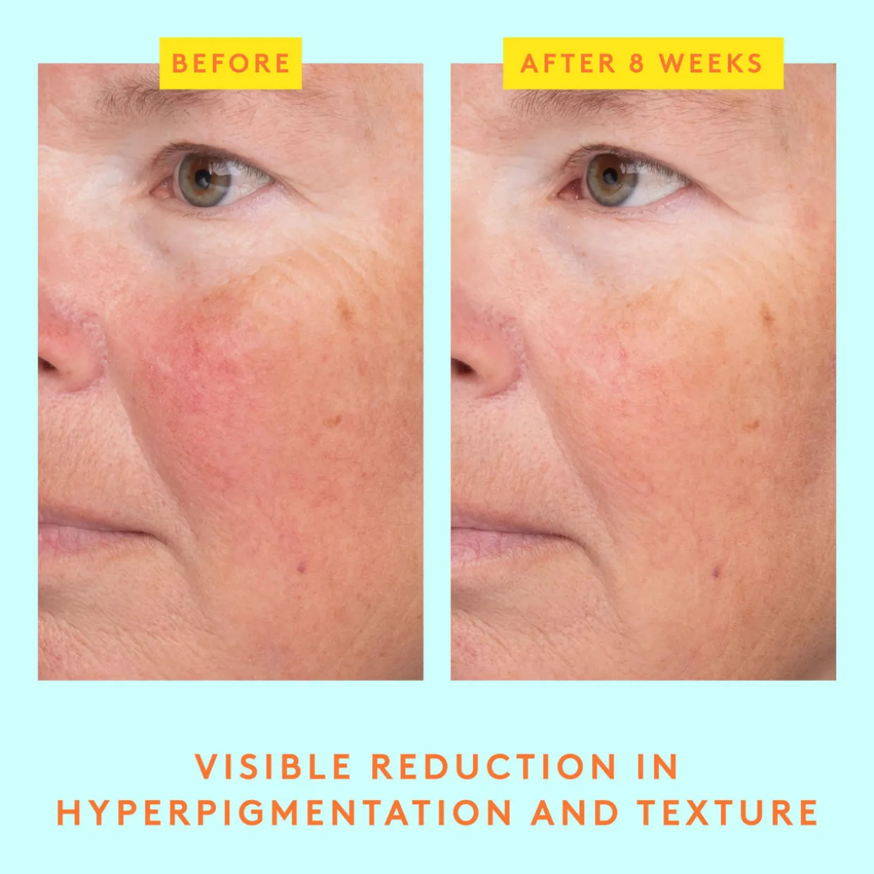 C-Luma™ Hydrabright Serum
