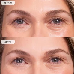 Miracle Blur Line Filler