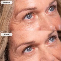 Miracle Blur Line Filler