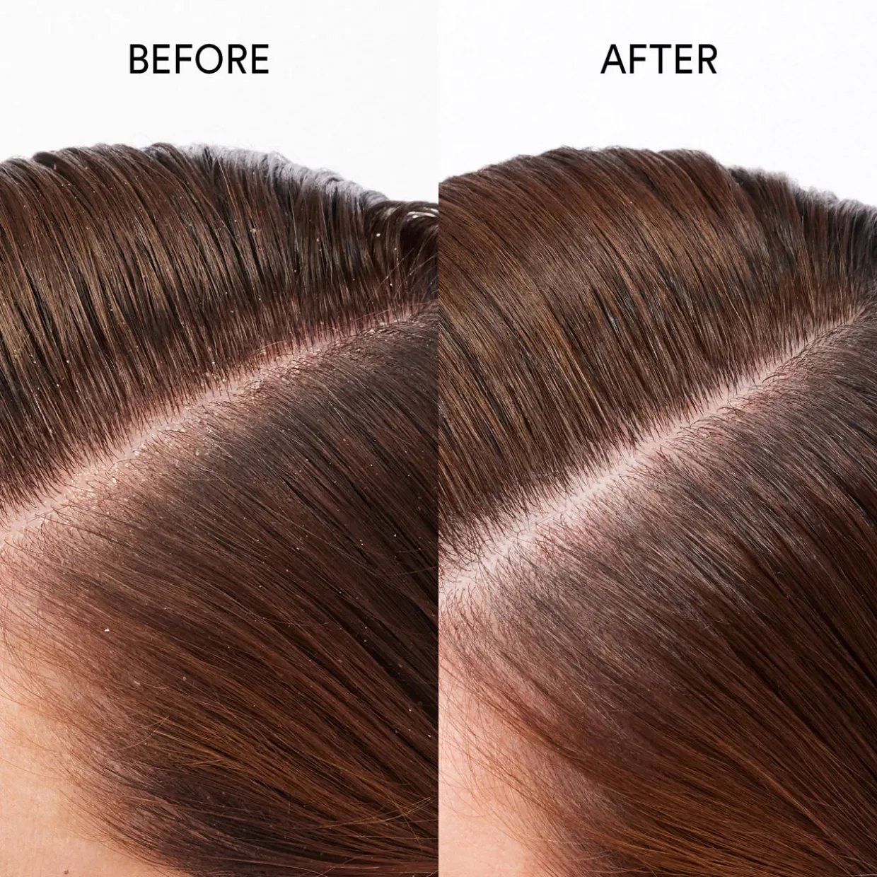 Pure Genius 98% Natural Scalp Restoring Oil