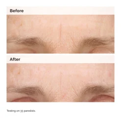 Retinal 0.2% Emulsion