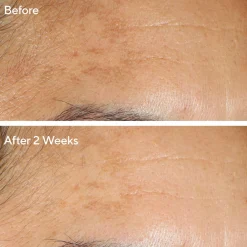 Serum Vita-C Glycolic