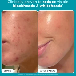 Skin Perfecting 2% BHA Liquid Exfoliant