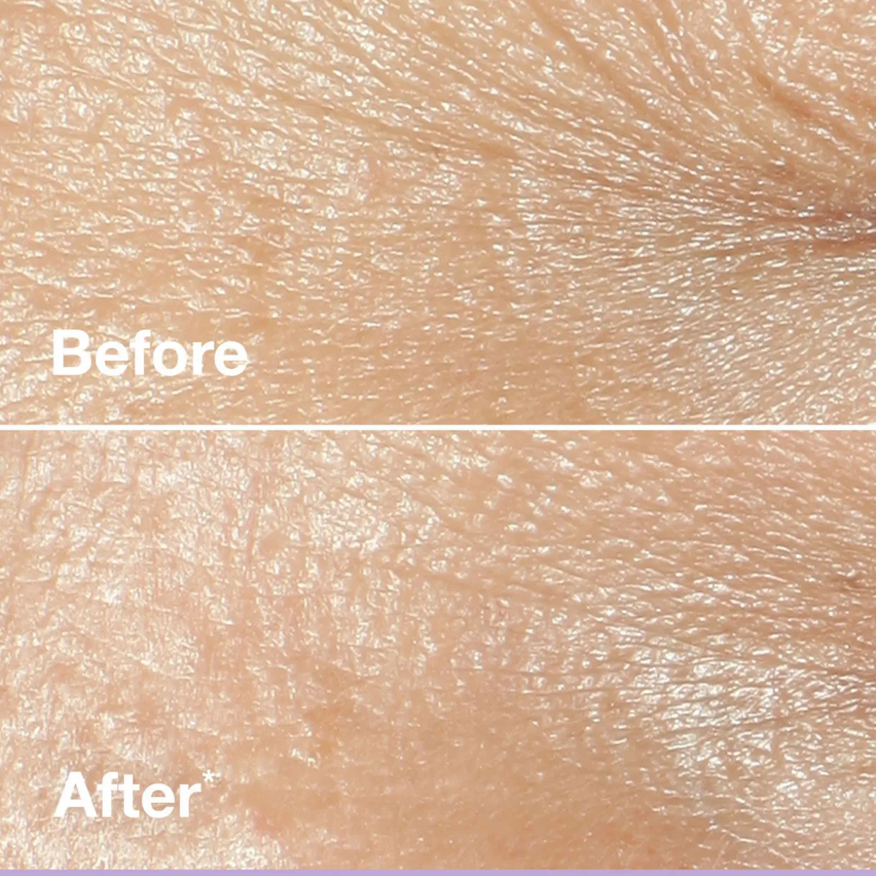 Smart Clinical Repair™ Wrinkle Correcting Cream