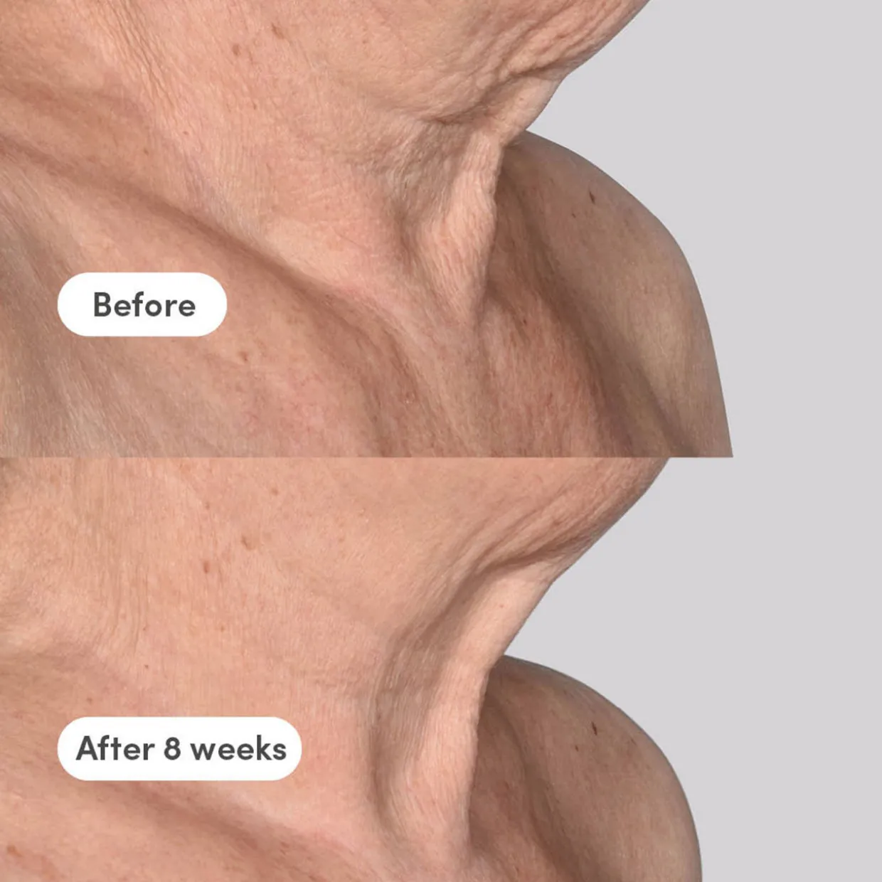 The Elevator Neck + Décolleté Concentrate