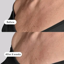The Elevator Neck + Décolleté Concentrate