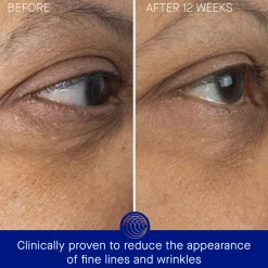 The Eye Cream Nomad