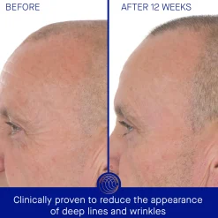 The Retinol Serum