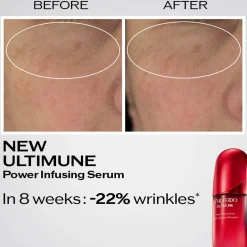 Ultimune Power Infusing Serum