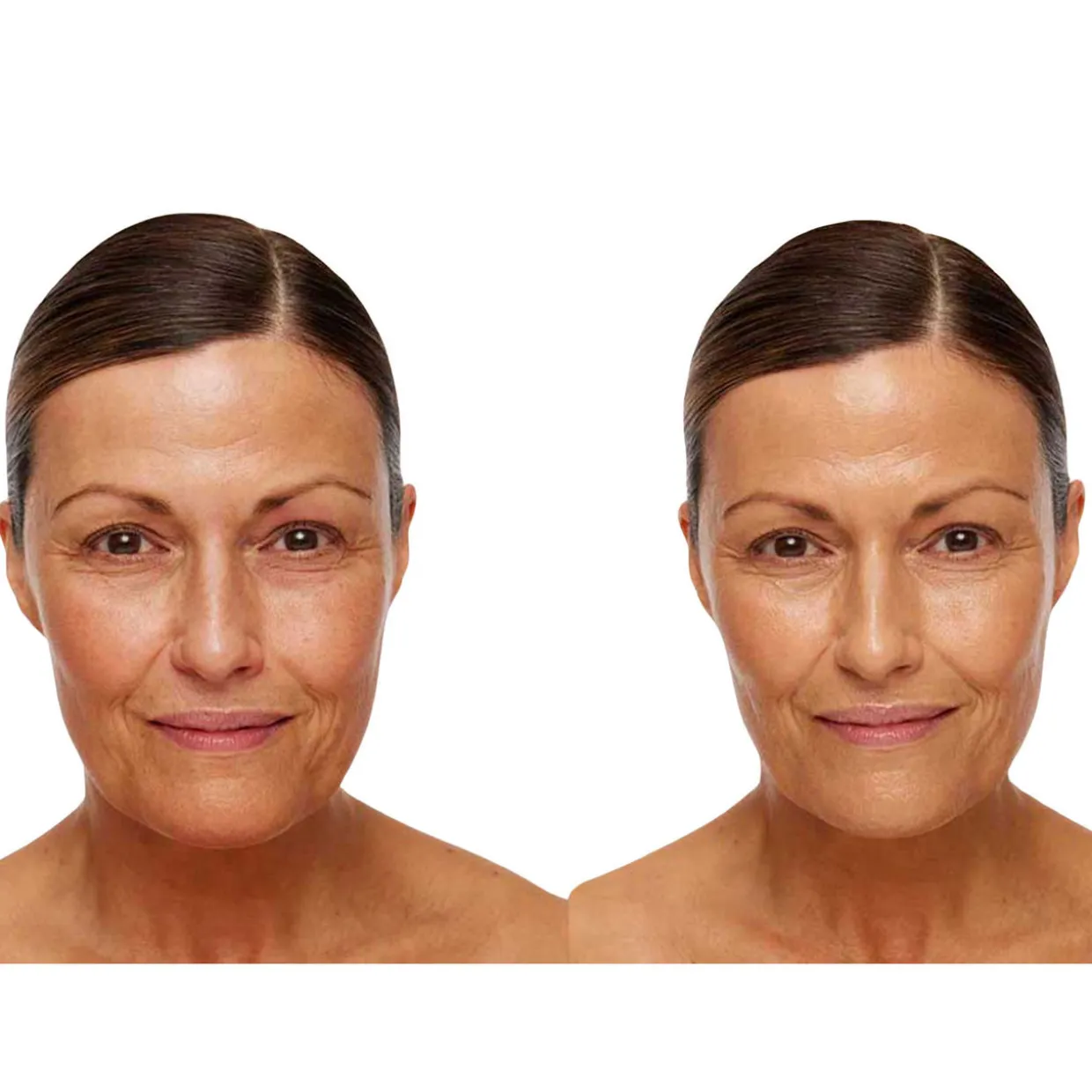 Universal Glow Treatment SPF30
